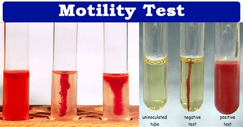 motility testing medium